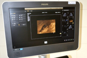 Przychodnia lekarza rodzinnego nzoz ppl Henryk Domański Pracownia Ultrasonografii Echokardiografii i Elastografii